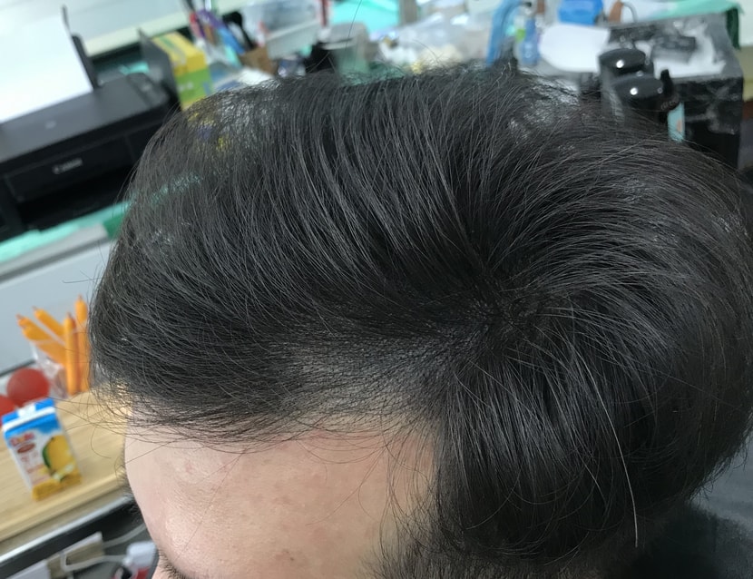 리터치 후