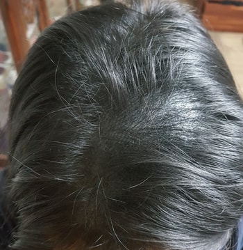 리터치받고 집에서