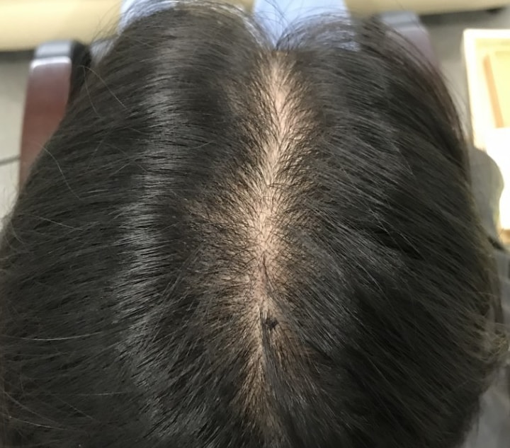 女性分け目のタトゥーを入れました~