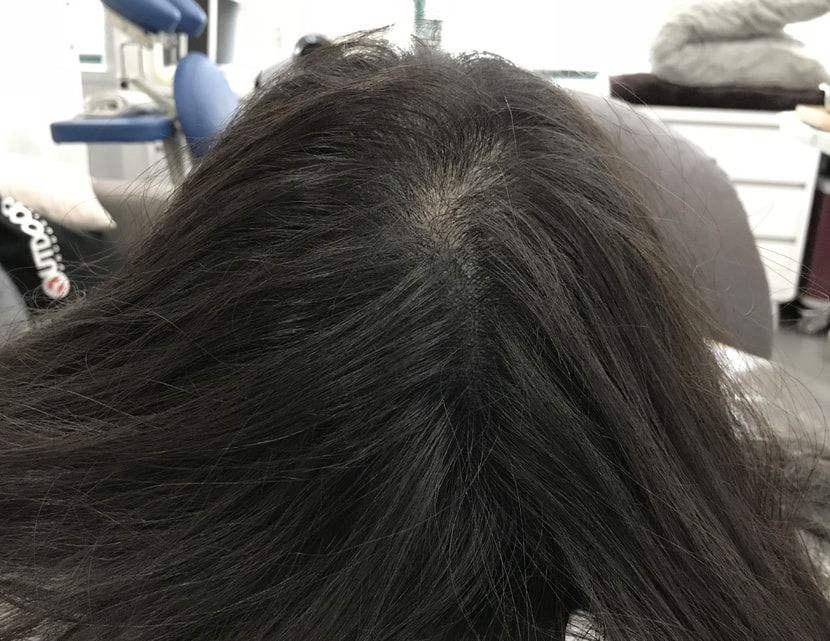 리터치 후