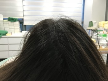시술후 병원에서 뒤