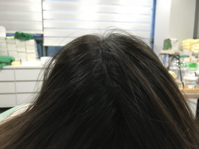 시술후 병원에서 뒤