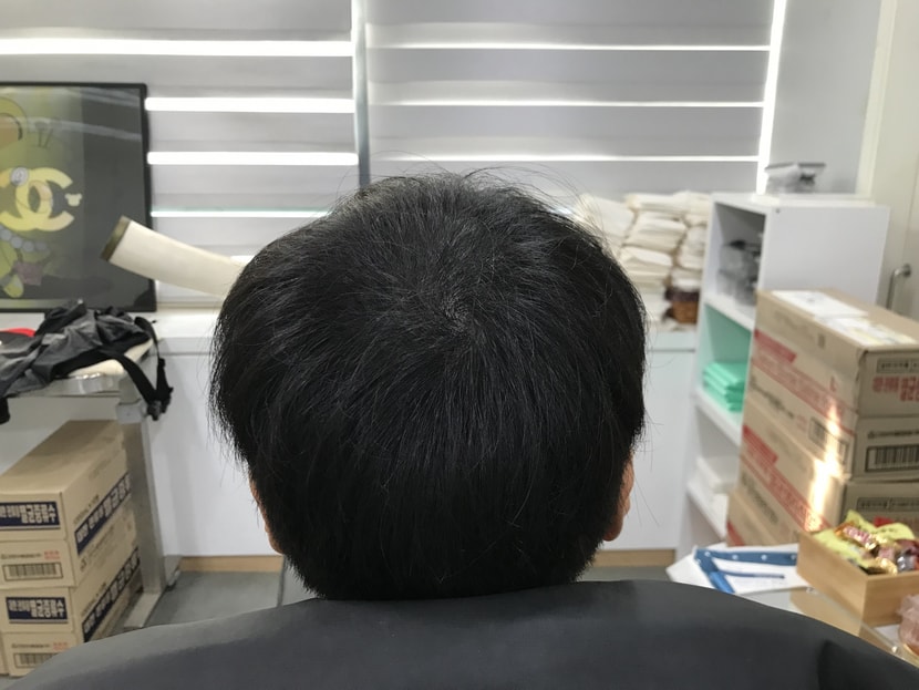 리터치 후