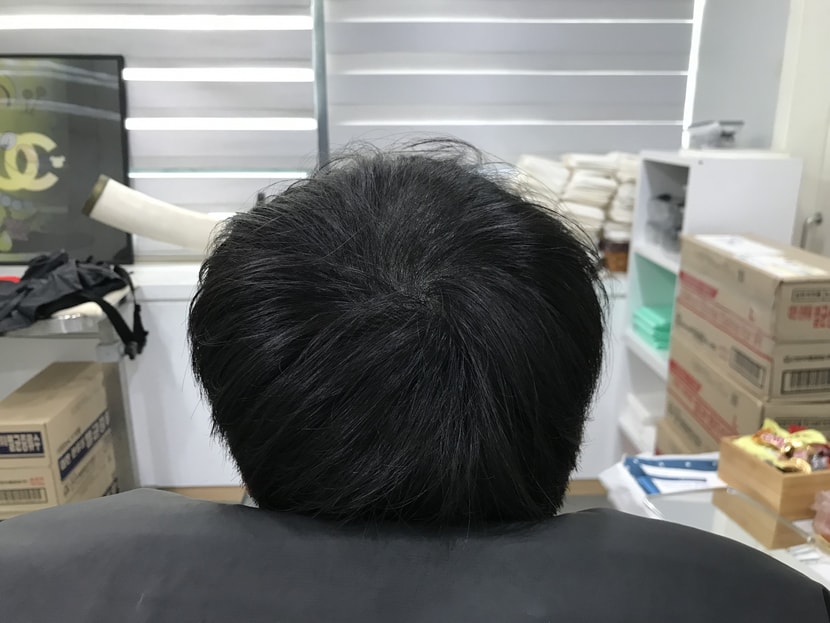 리터치 전