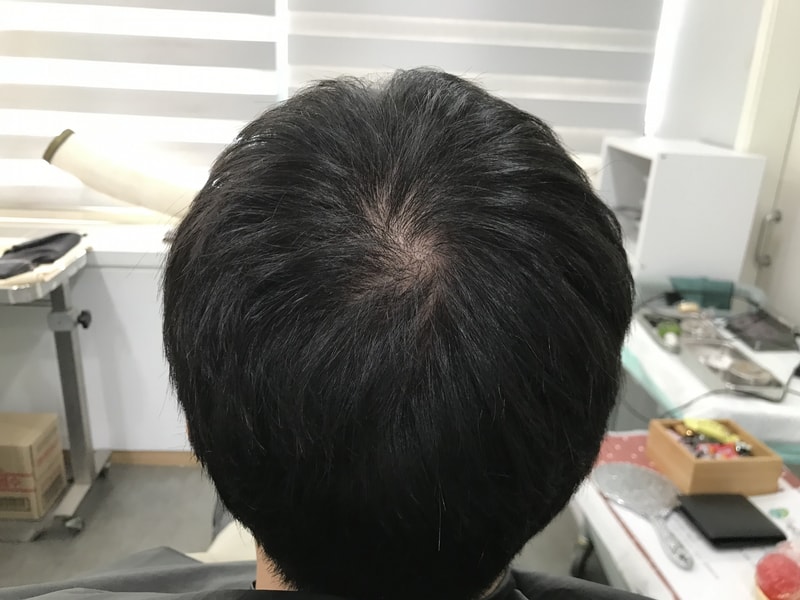 头皮纹身（渐变）后记！！