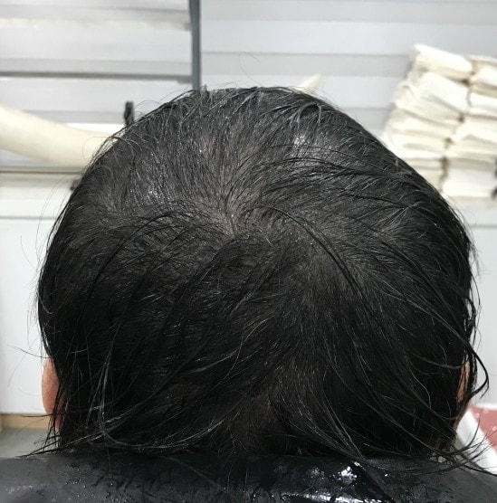 리터치후 젖은 머리   