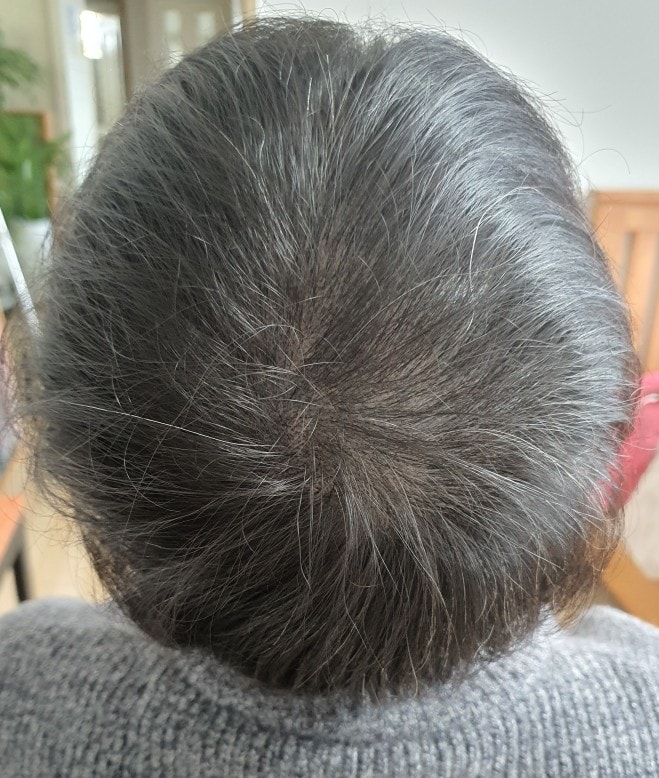 리터치 진행 후 현재상태 