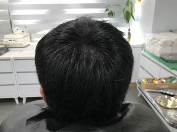 후 3
