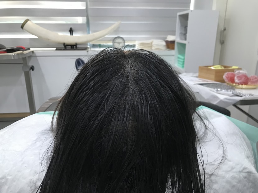 하고 난 직후! (머리 말리기 전)
