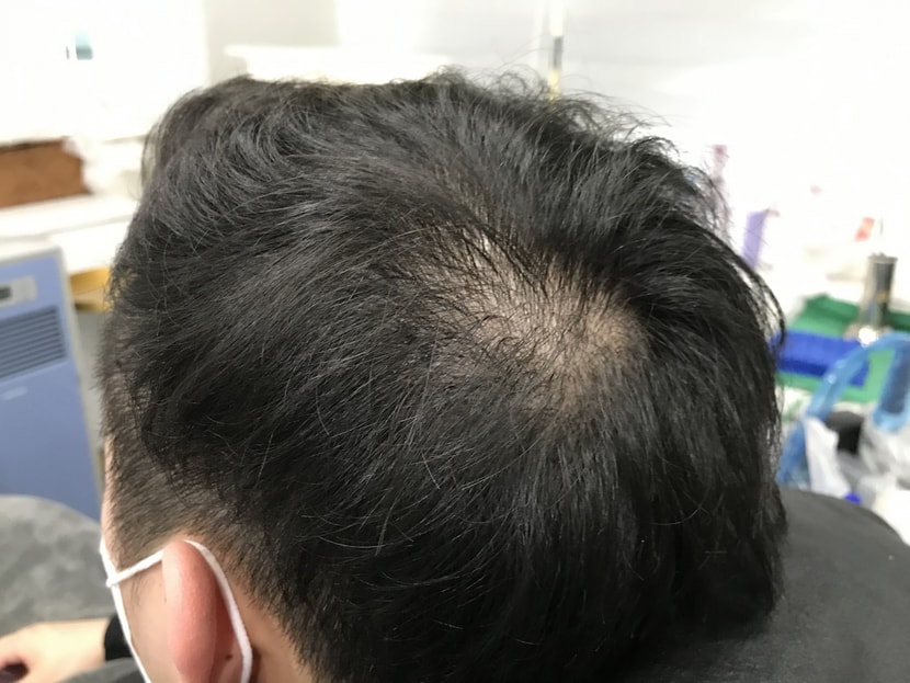 before