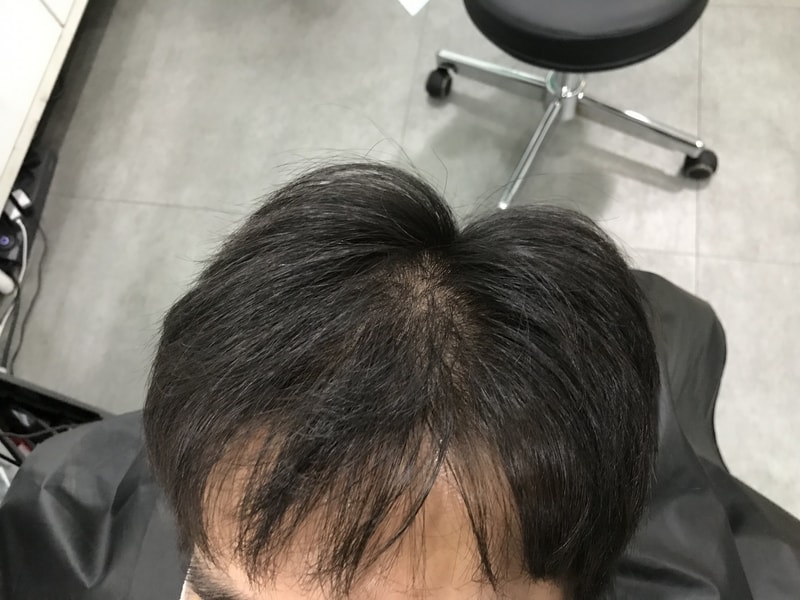 頭皮のタトゥー1次レビューです！