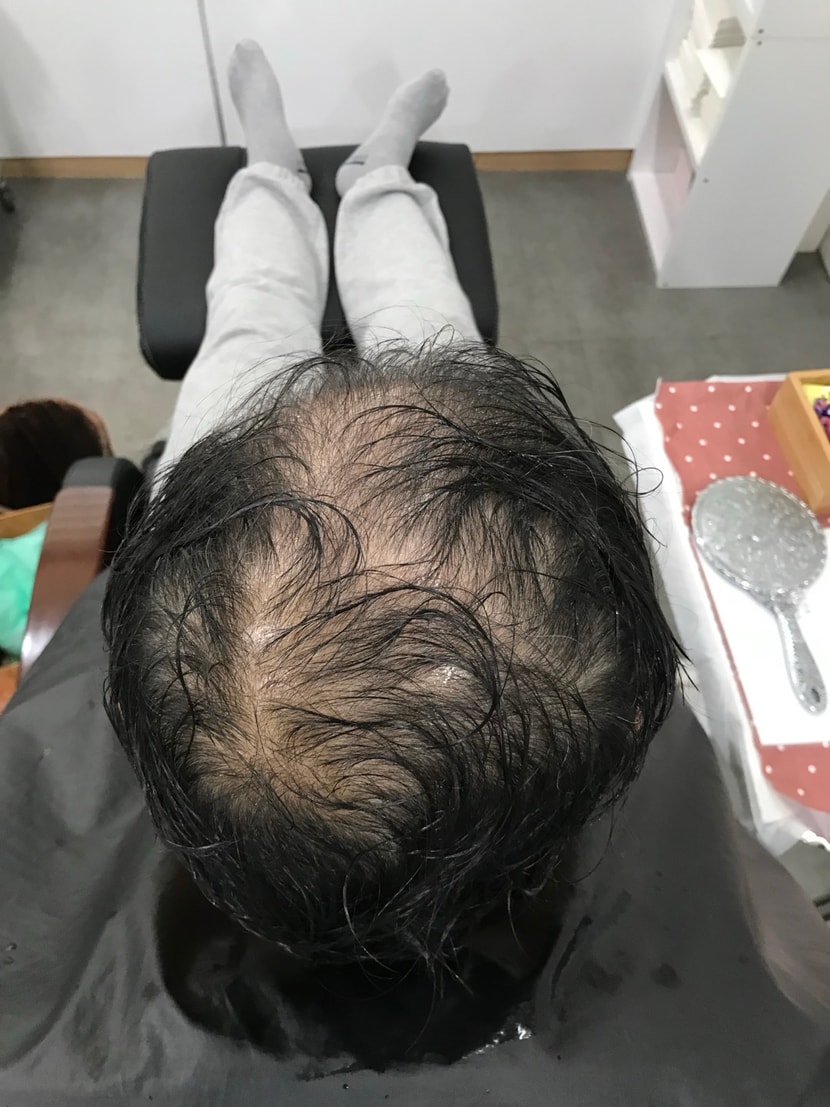 시술전 젖은상태
