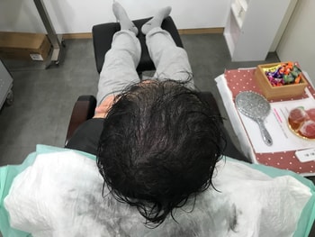 시술후 젖은상태