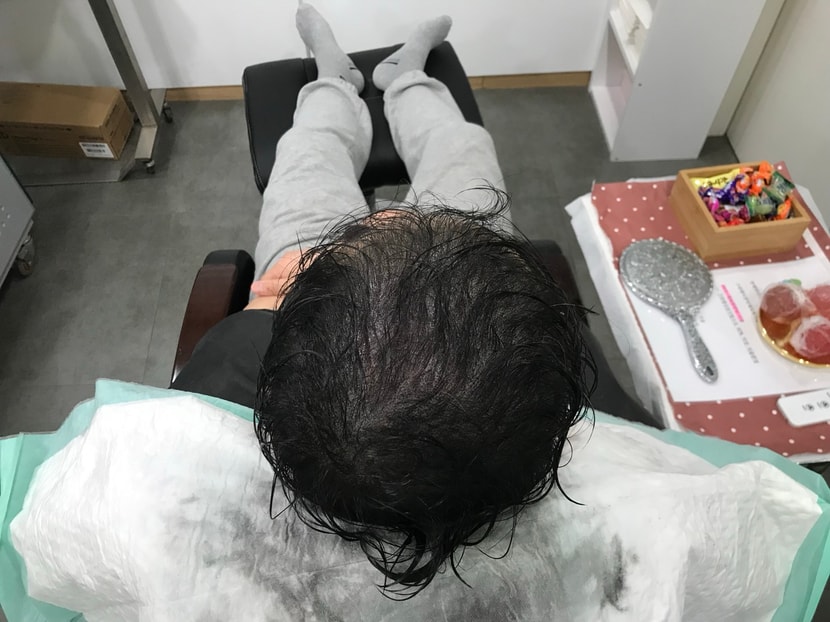 시술후 젖은상태