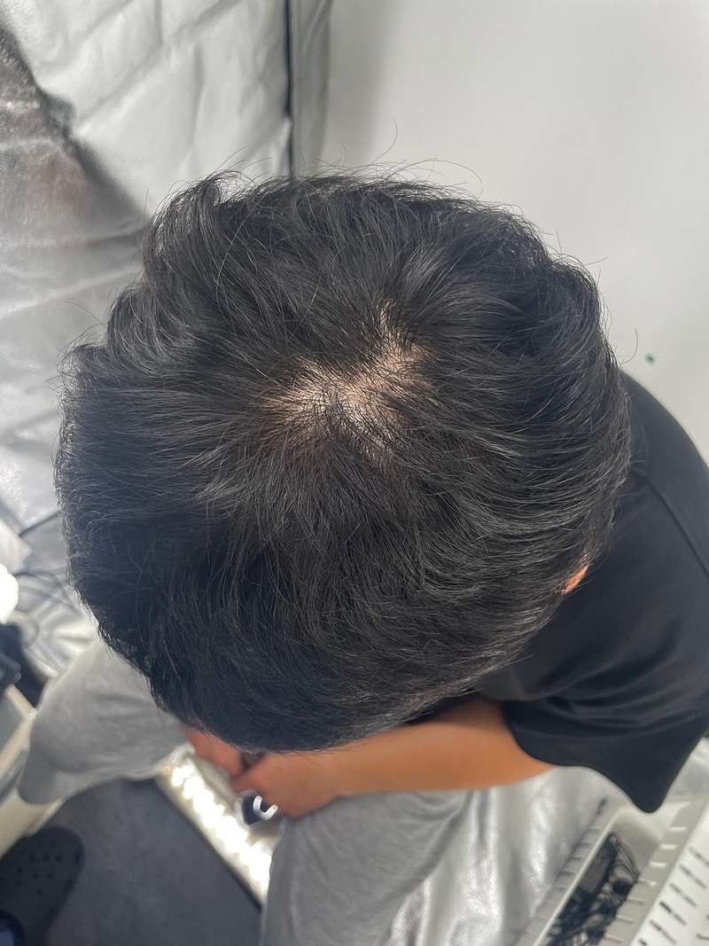 江南头皮纹身，推荐去新发型整形外科。