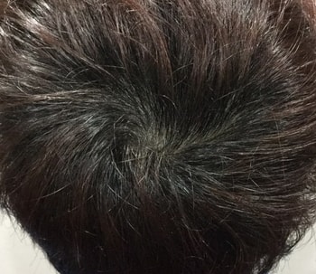 정수리