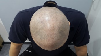 후