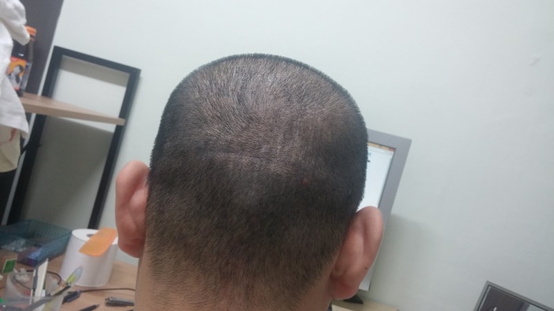 啊 这是纹头皮的最后评论 我剃了光头