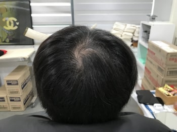 &lt;시술전 1&gt;