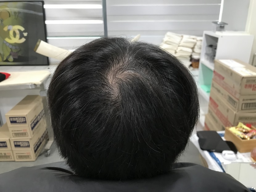&lt;시술전 1&gt;