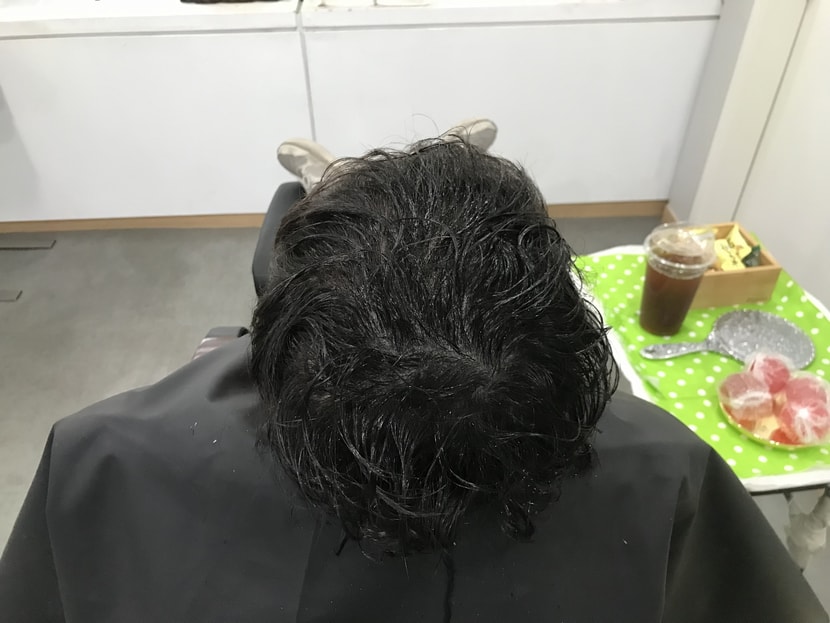 시술전