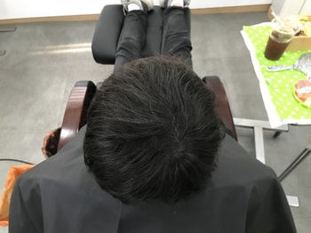 시술후