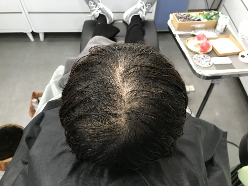 &lt;전&gt;젖은 상태