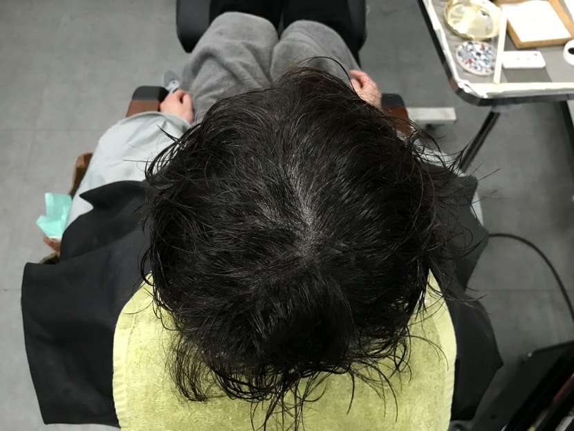 &lt;후&gt;젖은 상태