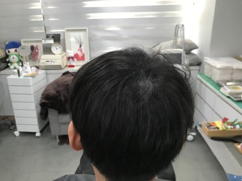 시술후1