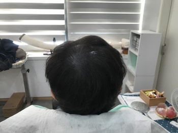 리터치후 사진