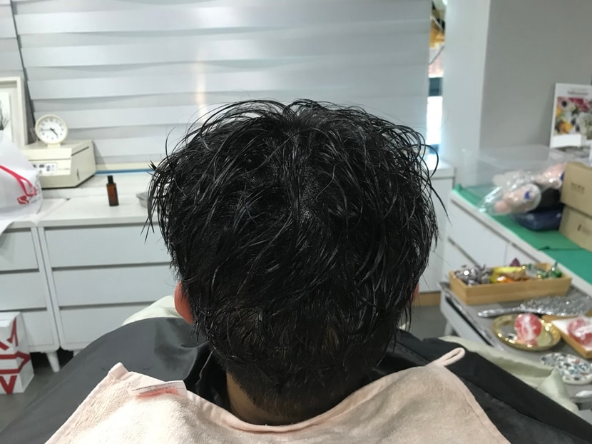 시술 후1