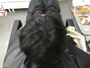 시술 후4
