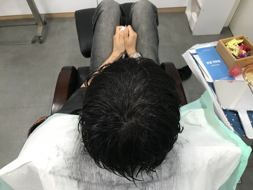 시술 후 젖은 머리