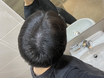 시술 당일 밝은 빛 아래