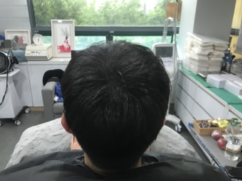 시술 직후 병원 드라이 머리