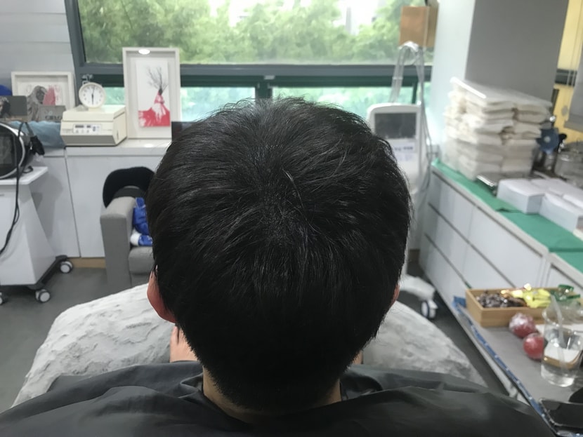 시술 직후 병원 드라이 머리