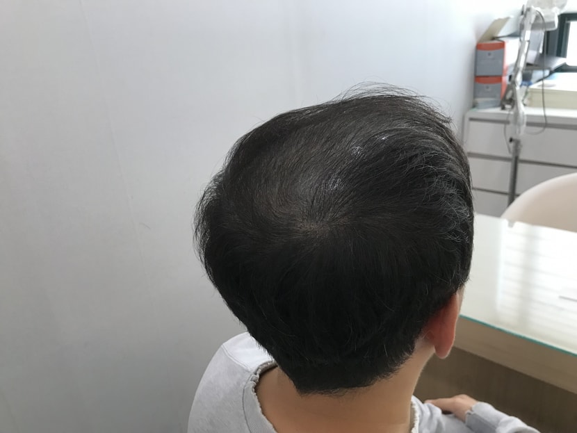 시술 2년차3