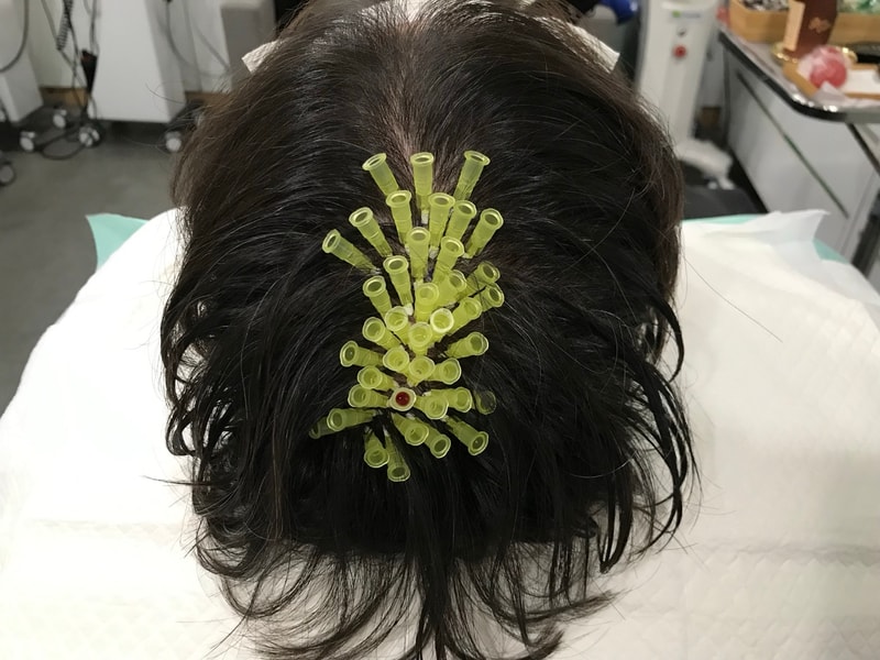 渐变圆点技法，头皮纹身