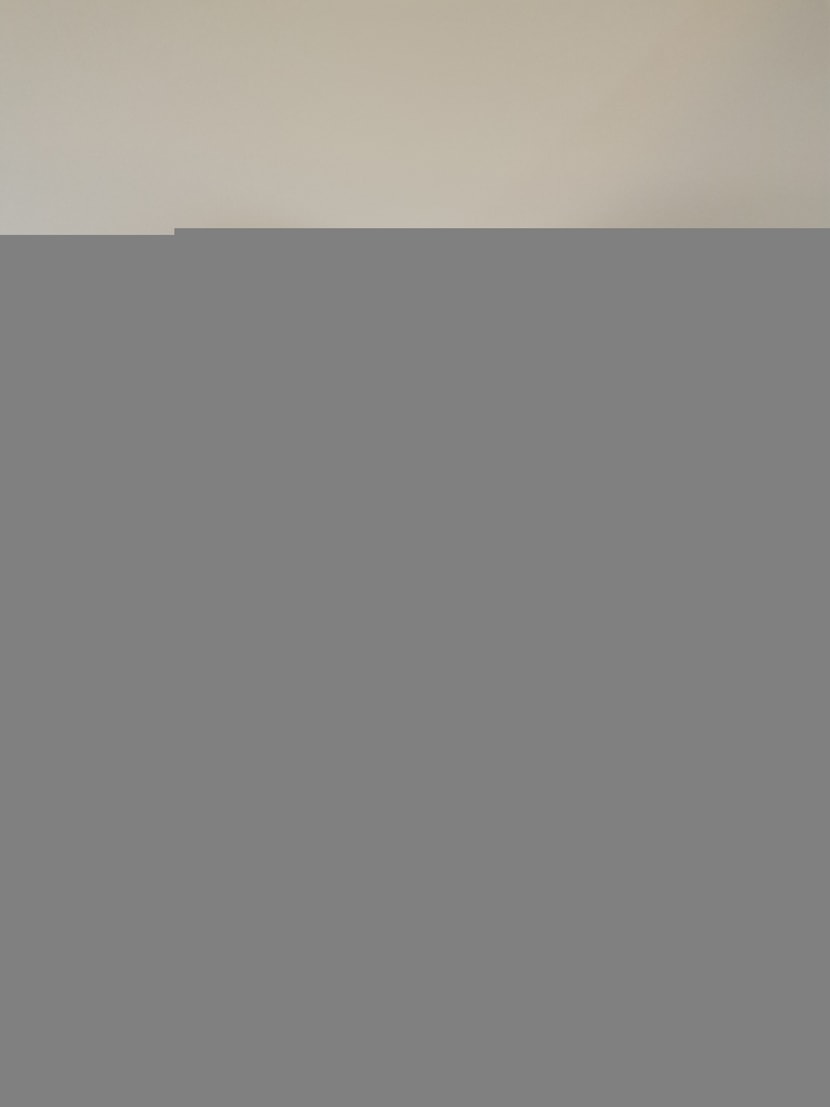 [1차시술&디자인만든사진]