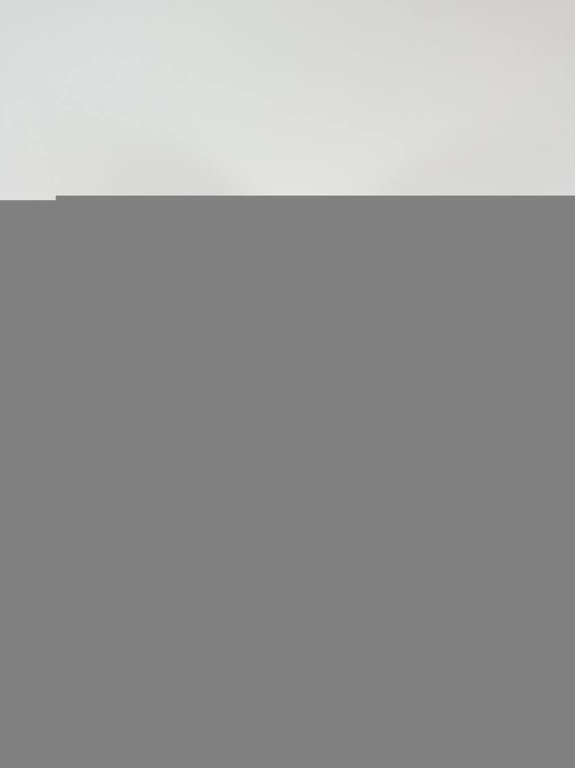 [시술전 사진입니다]