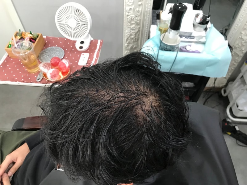 第一次纹身是延世大学人头皮
