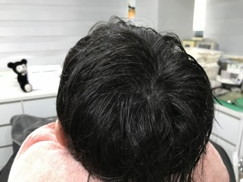 리터치 후 - 젖은머리