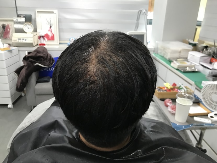 시술 전 젖은머리 1