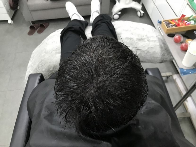 시술 후 젖은머리 2