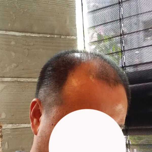 是smp 3周后半期。