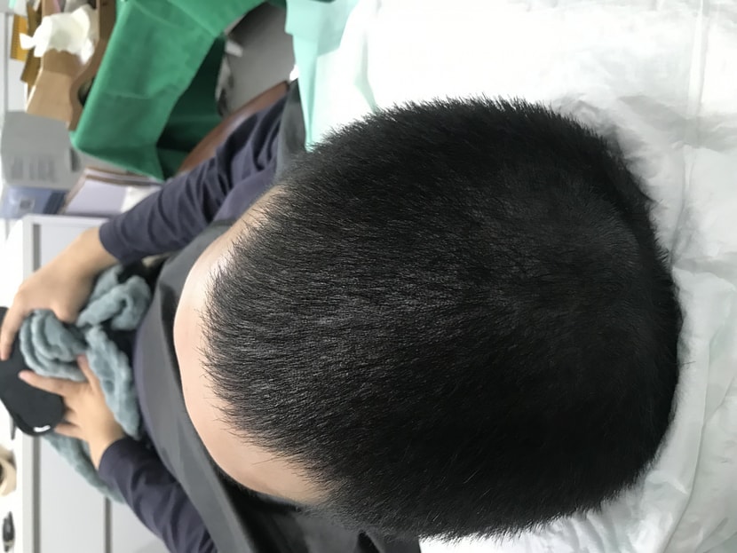 리터칭 끝난후 1