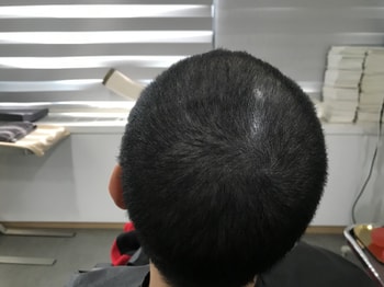 리터칭 끝난후 2