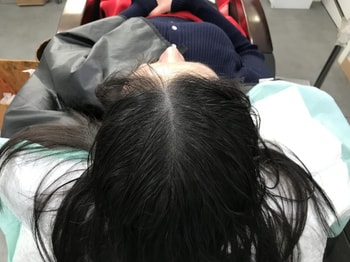 리터치 후 젖은모발