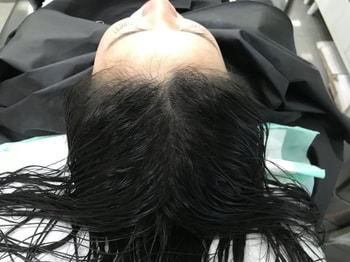 시술 후 젖은머리