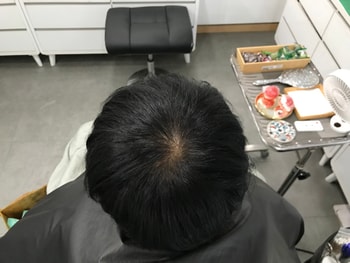 시술 전